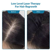 ZJKC 650nm Red Light Therapy Laser for Hair Regrowth Hair Loss Treatment Helmet