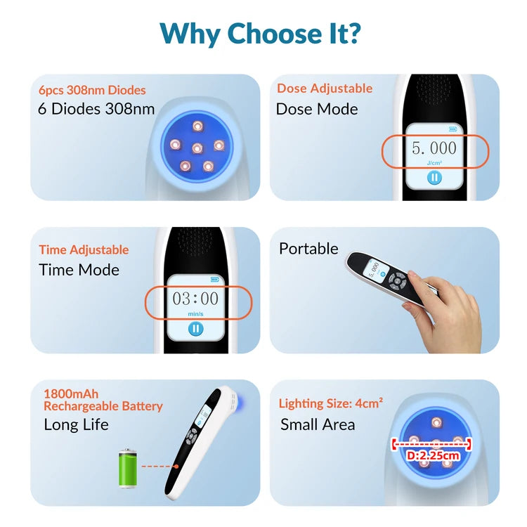 Handheld 308nm Excimer UVB Lamp – High Intensity, High Targeting Light Therapy for Vitiligo