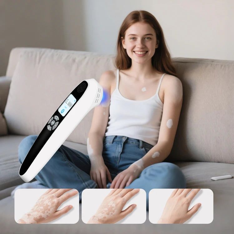 Handheld 308nm Excimer UVB Lamp – High Intensity, High Targeting Light Therapy for Vitiligo