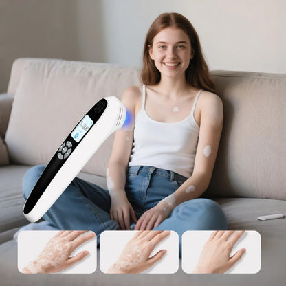 Handheld 308nm Excimer UVB Lamp – High Intensity, High Targeting Light Therapy for Vitiligo
